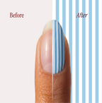 Riviera Stripes